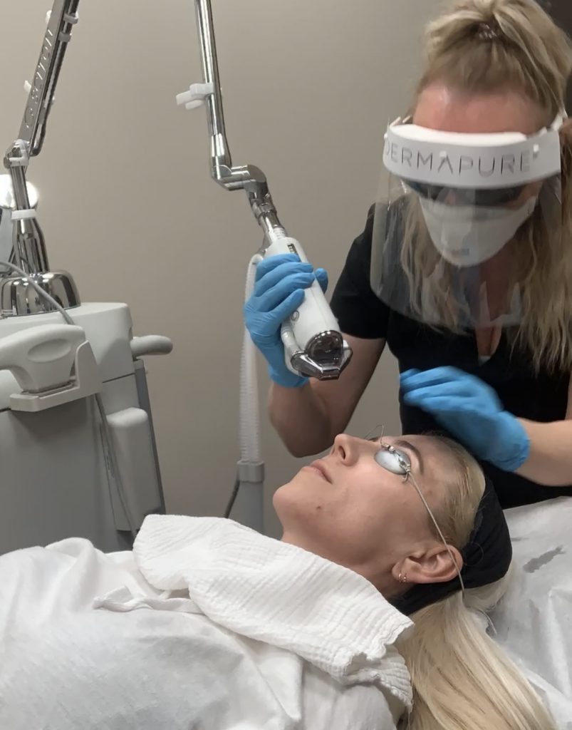 Dermapure Halo Treatment Katrina Olson