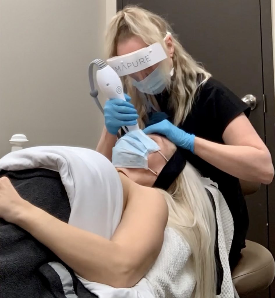 Dermapure Thermage Eye Treatment Katrina Olson